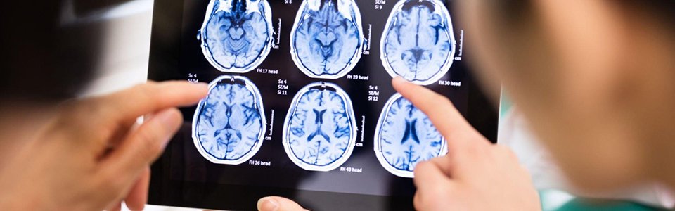 Neuropsychiatry Clinic