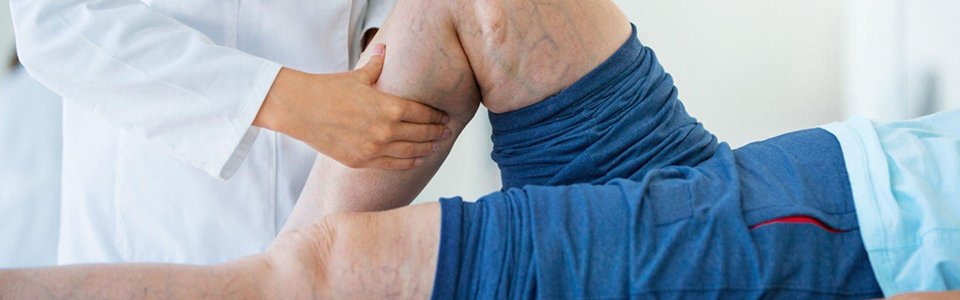 Varicose Vein Clinic
