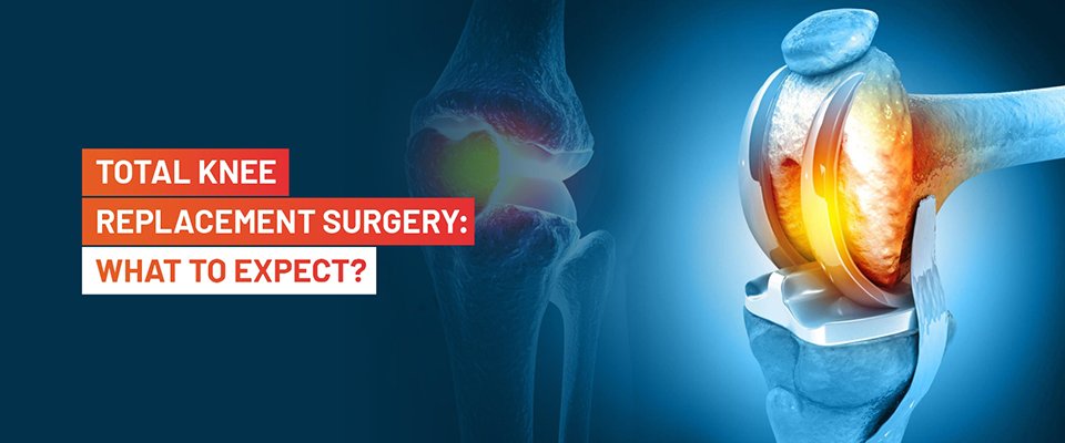 Total Knee Replacement Surgery: What To Expect