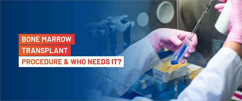 Bone Marrow Transplant - Procedure And Who Needs It?
