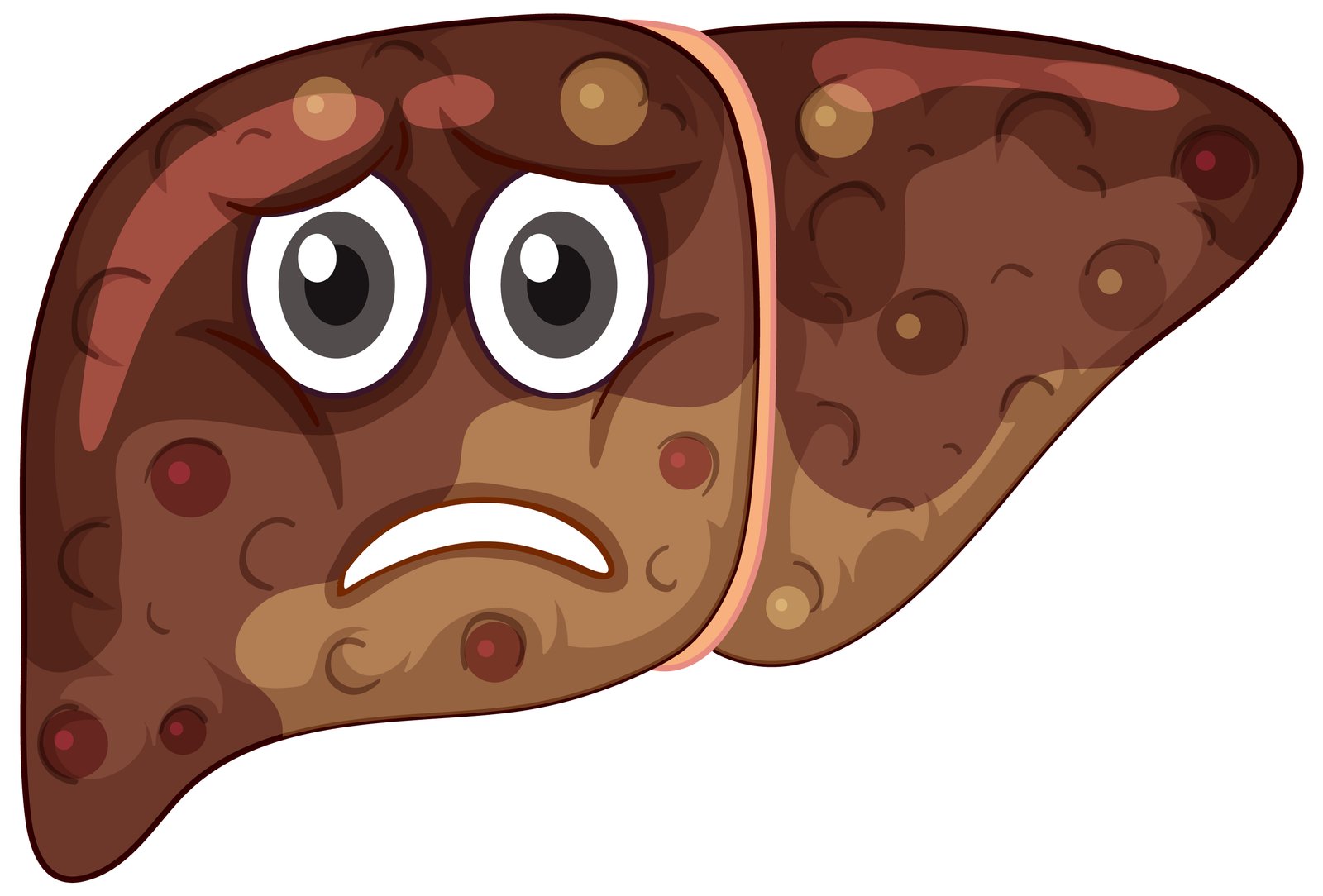 Fatty Liver Disease Causes, Symptoms, and Risk Factors