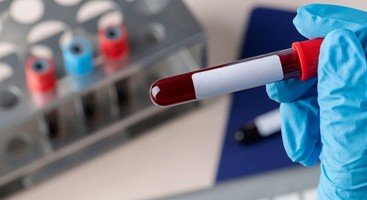 Understanding Blood Tests: Decoding Your Health Report