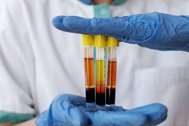 Benefits and Risks of PRP for Fertility: A Comprehensive Guide