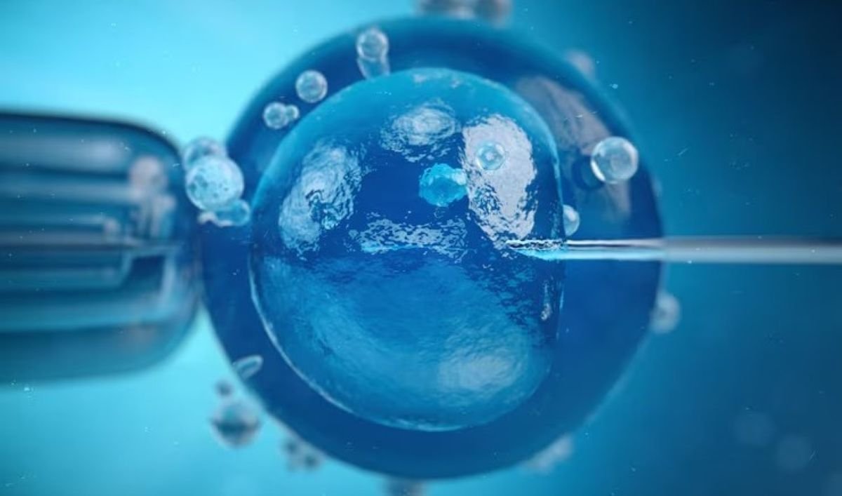 Frozen Embryo Transfer (FET) and Its Impacts