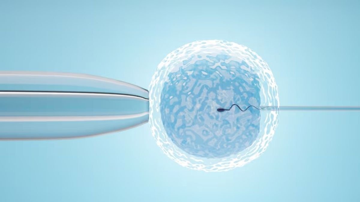Understanding Donor Egg Gametes: A Comprehensive Overview