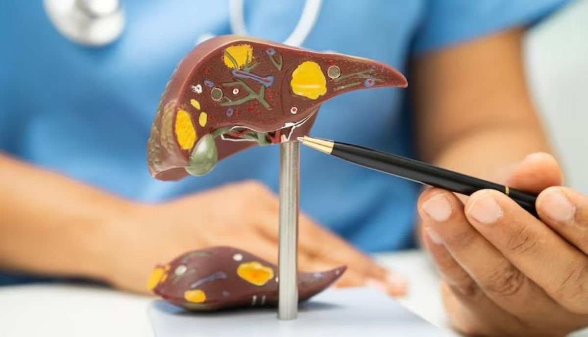 Understanding the Liver Transplant Process