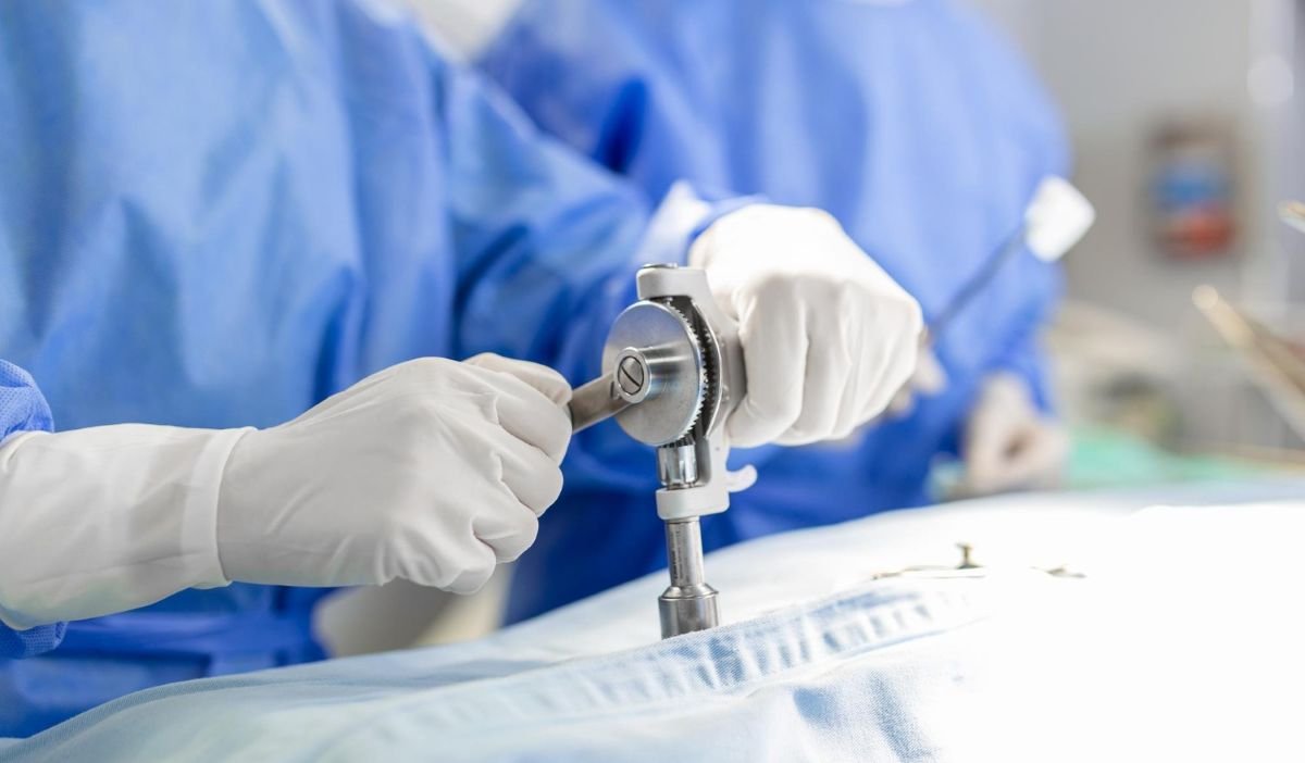 What is Laparoscopy? Minimally Invasive Surgery Explained