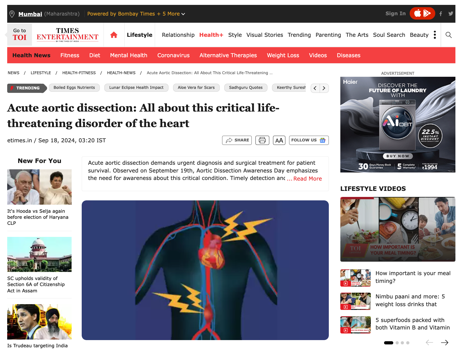 Acute aortic dissection: All about this critical life-threatening disorder of the heart